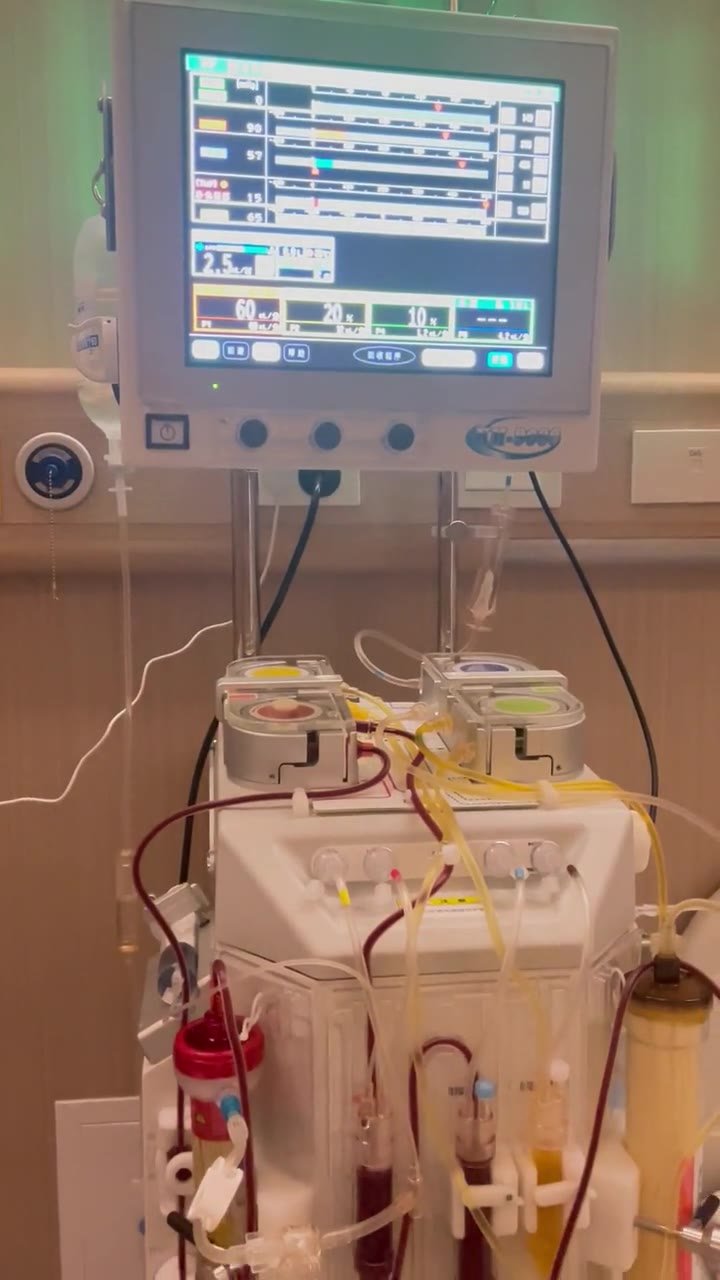 Blood purification equipment interface and tubing workflow